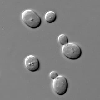 Black and white photograph showing budding yeast cells under a microscope.