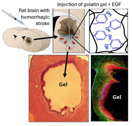 A composite image consists of a rat brain with hemorrhagic stroke, injection of gelatin gel to the brain, and lesion changes after the injection.