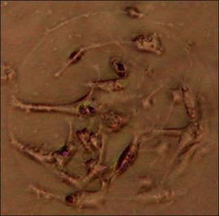 Neurons forming a network in disassociated cell culture.