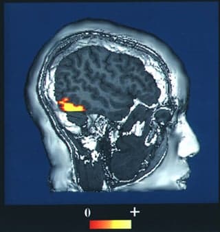 A computer-enhanced fMRI scan of a person looking at faces. The image indicates increased blood flow in the visual cortex.