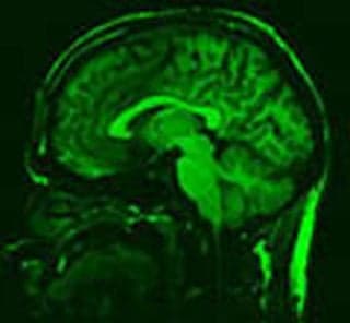 An image of a Midsaggital brain scan of a human.